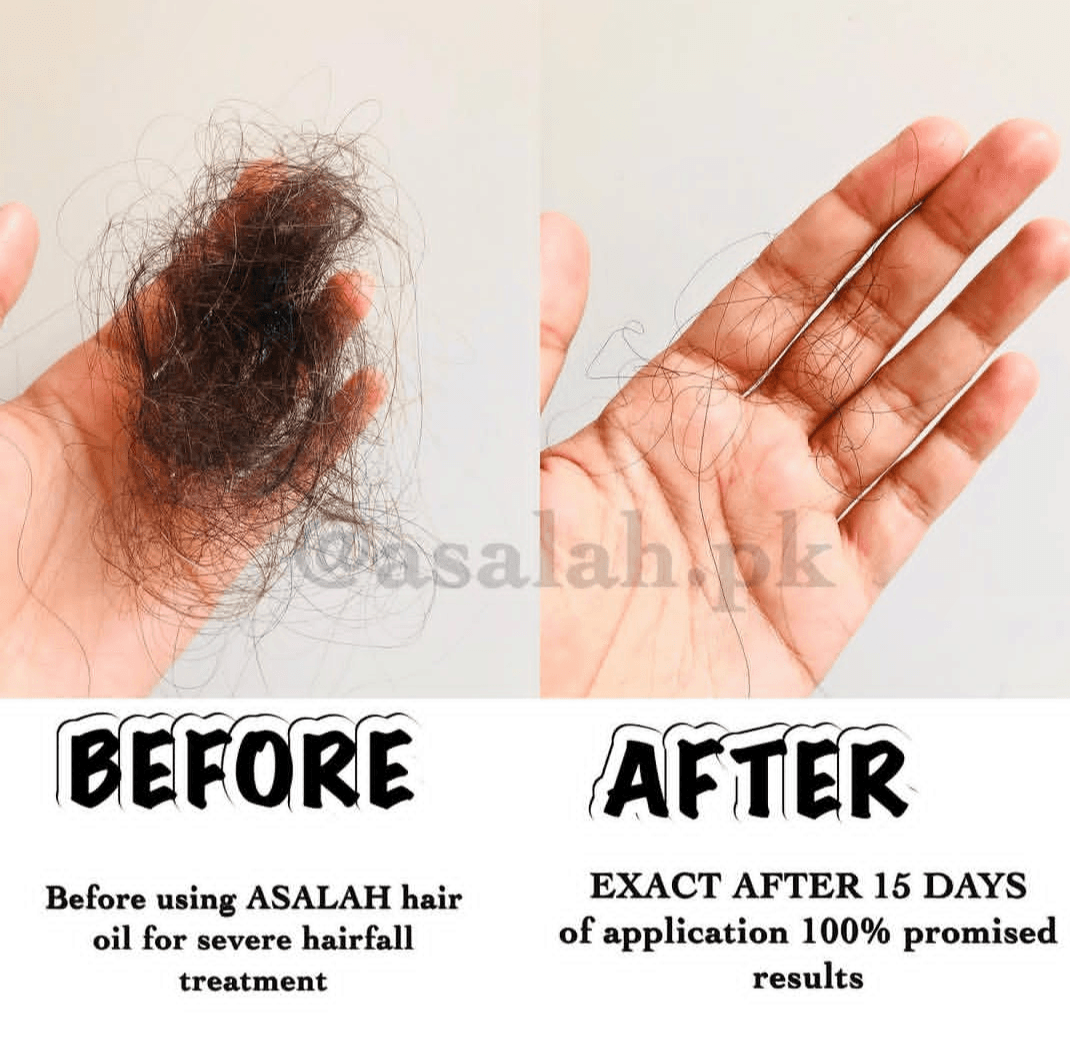 100% Hair Fall Treatment Hair Oil - Image 4