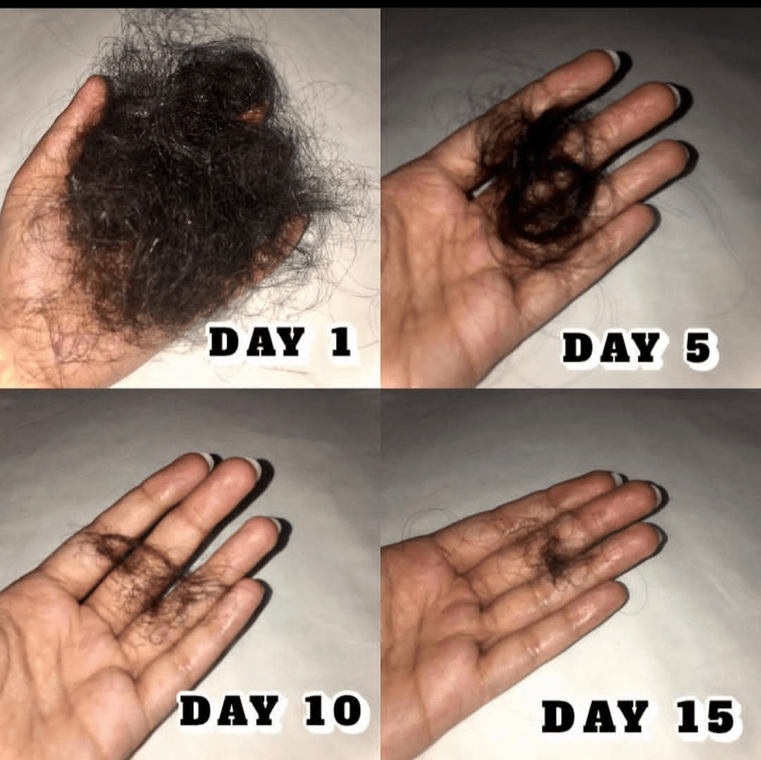 100% Hair Fall Treatment Hair Oil - Image 5